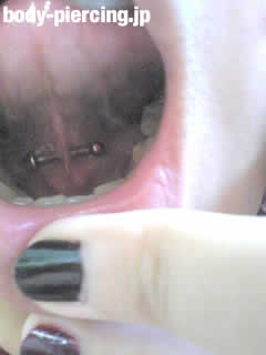 苺宮さんの舌の裏筋・タンウェブのボディピアス写真