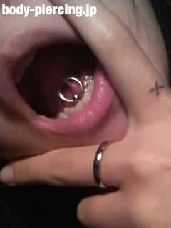 玲奈君(14)さんの舌の裏側にある舌と顎をつなぐ筋の部分のピアッシング・タンウェブのボディピアス写真。