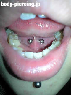 大江さんの口と舌の裏筋のボディピアス写真